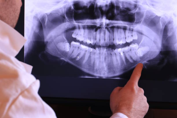 Best Emergency Treatment for Dental Infections or Abscesses in Blauvelt, NY